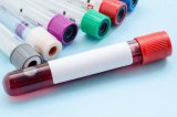 Study reveals inequalities in treatment of blood cancer patients