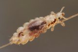 So THAT's The Difference Between Nits And Head Lice