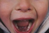I'm A Therapist – Say This 1 Thing To Your Kid If They Bite Another Child