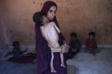 Children In Gaza Are Starving. Talking Is Not Enough.