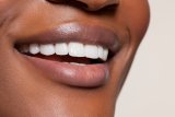 Dentists Are Begging You To Stop Using These Viral Teeth-Whitening Hacks