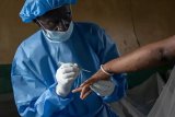 Sierra Leone declares monkeypox public health emergency