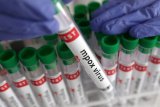 Mpox still a health emergency: WHO