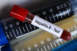 MERILYNN STEENKAMP | The journey from detection to protection: inside South Africa’s hepatitis (…)