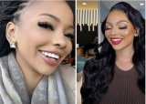 Mihlali Ndamase trolled over ‘botched’ new veneers