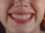 This Gross Addition To Toothpaste Is Actually Best For Natural Enamel Repair