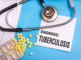 Critical TB research in South Africa at risk after US aid cuts