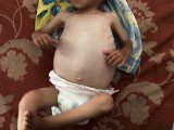 Israel Is Using Starvation To Commit Genocide In Gaza, New Amnesty Report Says