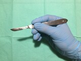 KZN rolls out controversial circumcision device amid safety concerns