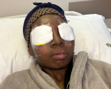 'My eyes were burning': woman hospitalised after lash extension nightmare