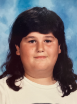 I Had My Stomach Stapled At 14 Years Old. That Surgery Didn't 'Cure' Me – Far From It.