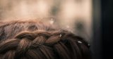 The Surprising Reason Your Dandruff Is So Bad Right Now