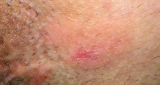 I Had An Itch In A Very Private Spot. Things Turned Tragic After I Asked My Doctor A Simple (…)