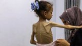 Gaza’s horror through a mother’s eyes as famine and war rage on