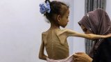 The worst-case scenario: famine declared in Gaza amid ongoing conflict