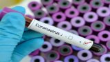 Unmasking the 'Zombie' Cells: The shocking link between ME/CFS and Long Covid