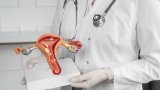 Preserving hope: Cervical cancer and the options for women's fertility