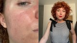 I Was A Collagen Supplement Sceptic – This Brand Loved By Skin Doctors Changed My Mind