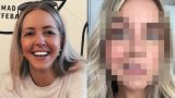 I Took My Appearance For Granted. Then My Face Changed And My Life Transformed Overnight