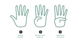 This 1 Thumb Test May Indicate If You're At Risk For A Heart Problem