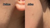 These Eco-Friendly Dermaplaners Are So Good, They Had A Waitlist – One Sells Every Second