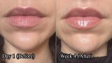 This Product Is Meant To Plump Your Lips Instantly And Over Time – Here Are My Honest Thoughts
