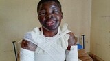 ‘At least justice did not fail me’: Limpopo acid attack survivor welcomes 20-year sentence