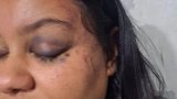 Suspended officer's girlfriend defends him amid assault allegations