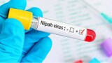 No need for panic over Nipah virus – Indian doctor