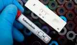 News24 | IN THE SPOTLIGHT | TB’s tight grip: Why this curable disease is so hard to treat