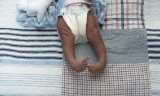 ‘I looked at those tiny feet’: Joburg mother’s journey helped thousands of children walk without pain