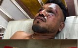 News in a minute | Updates from Air India’s sole survivor [video]